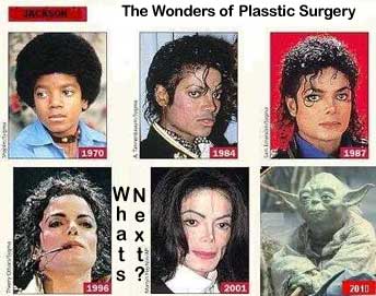 Michael Jackson - The Wonders of Plastic Surgery